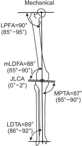 胫骨远端外侧角(mldta,正常:89(86~92.