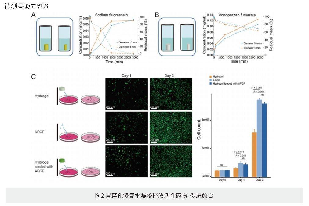 内镜下可递送和蘑菇帽启发的双曲面形载药生物粘附