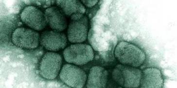 “猴痘”是什么？有哪些传播途径？如何科学应对猴痘病毒？