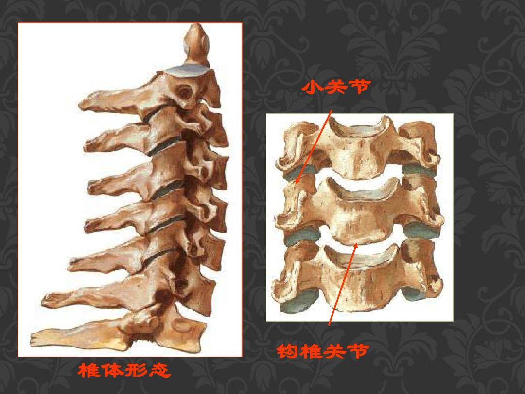 上关节面钩,关节囊后面及内侧均有韧带加固;寰枢正中关节 由齿突 与