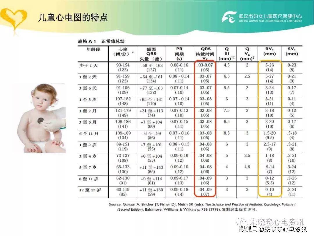 儿童心电图