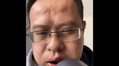 秃头大叔能变回精神小伙吗?