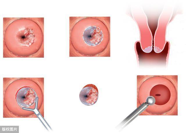 女性各种B型下面尿道图片