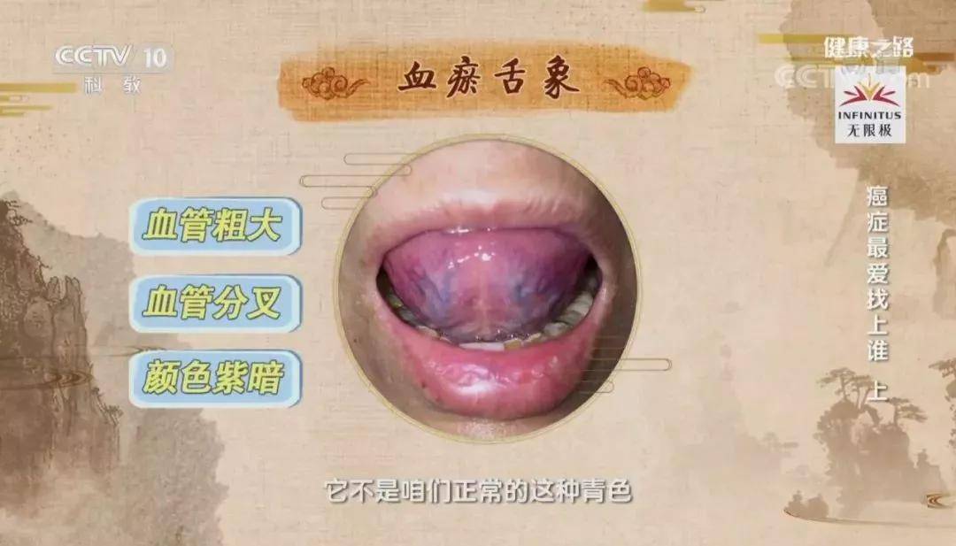 防癌方快收好