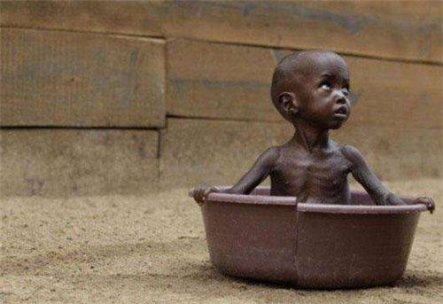 原创让人流泪的照片:里面饿的只剩皮包骨的小女孩,最后活下来了吗?