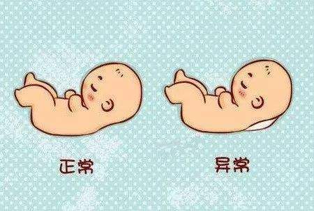 孕期nt检查最佳时间以及nt检查报告单解读