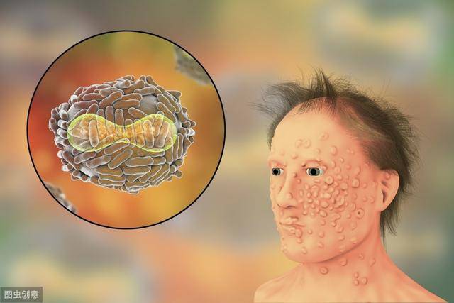 3000多年前就存在的"瘟疫",被乡村医生找到解决方法