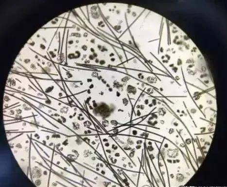 河蟹,小龙虾养殖户注意:六月下旬蓝藻爆发,什么办法有效根治?_水体