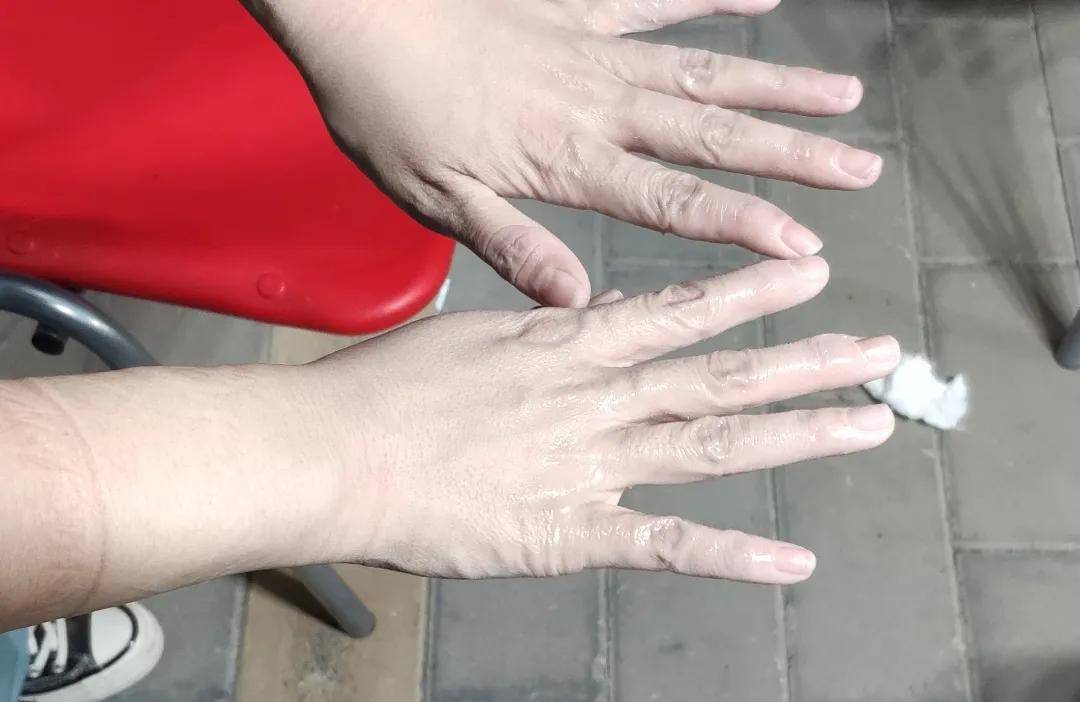 抗击疫情一线他们是烈日下的逆行者