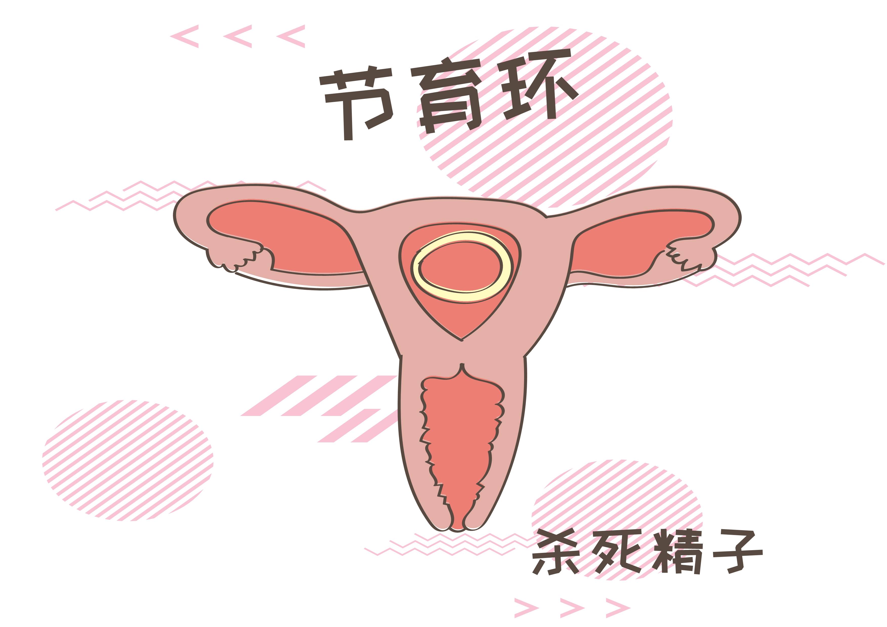 节育只是女人专利吗?男人多看一看,你的妻子正在承受怎样的痛苦