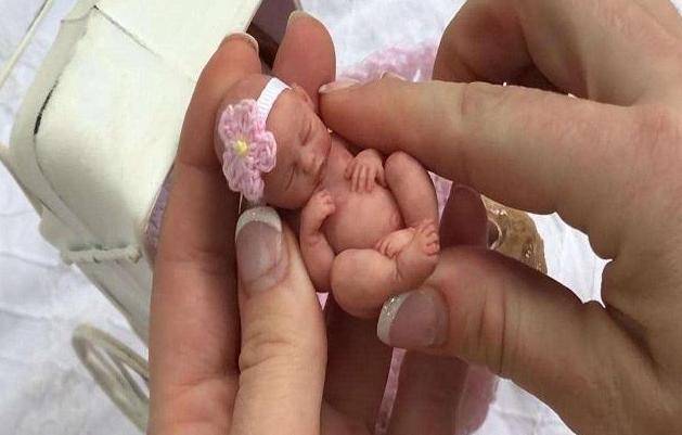 14年前的手掌婴儿,出生仅一个手掌大小,如今怎么样了