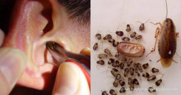 杜绝蟑螂深夜在耳朵安家,应当这么做!