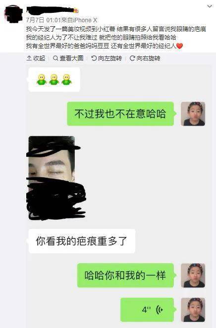 原创小猪放风再玩多人运动周扬青曝近况整形疤痕被抓包