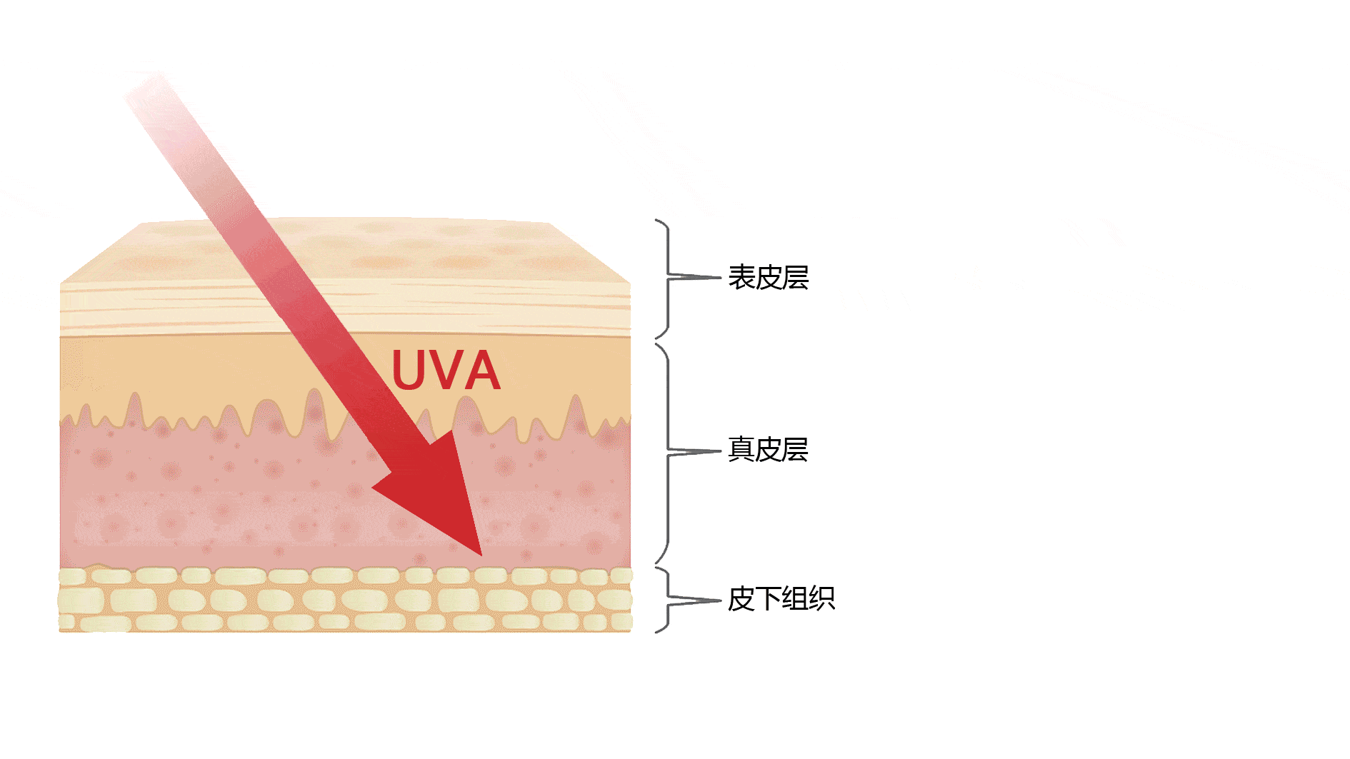 uva一旦对皮肤造成伤害,就是不可逆的进而直接伤害肌肤的真皮层,是晒