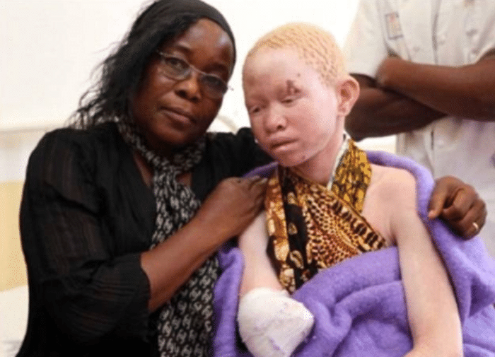 非洲"最昂贵"的血液,一滴血比黄金还贵?事实让人捧腹大笑_部落