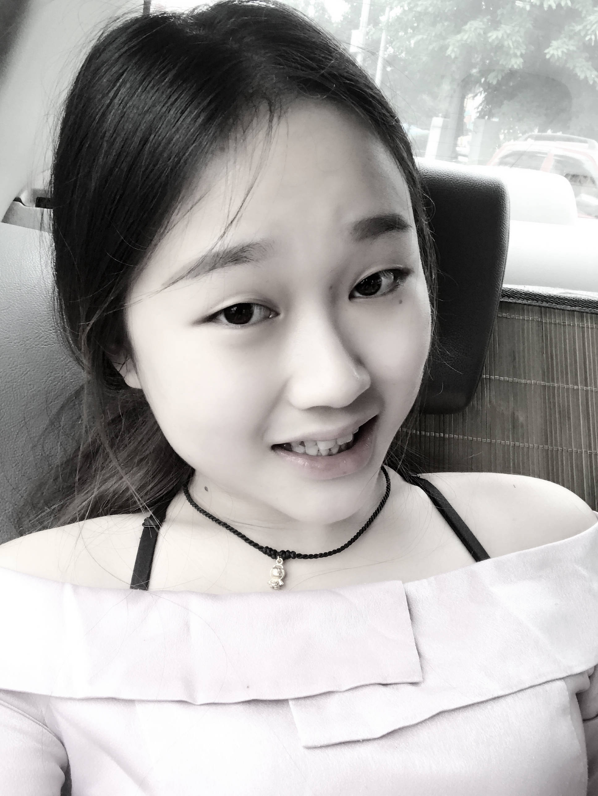 普拉张尚风鼻综合分享 ‖ 一个鼻子给我带来的改变