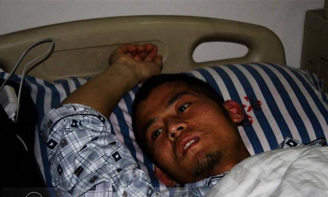 肝硬化来临之前,身体发出6个"出击"信号,记住就等于自救