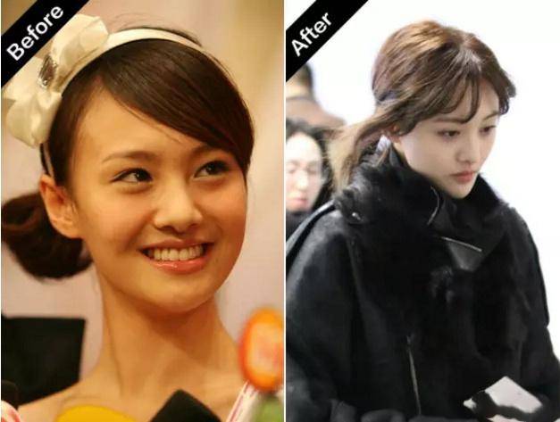 女生发量少适合什么发型?参考明星们的小秘诀_头发