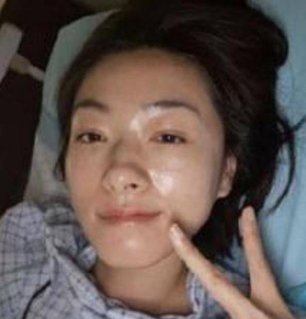 万茜车祸后住院晒自拍自夸拍照时没用美颜调侃的方式报平安