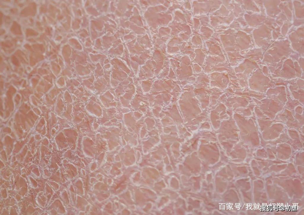 鸡皮肤太丑了怕被别人看见(鸡皮肤太丑了怕被别人看见吗)