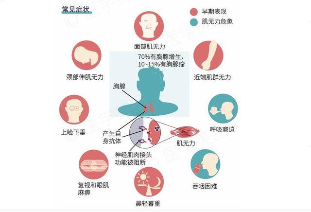 重症肌無力患者一定要知道哪些方法對於病情的幫助,在飲食方面要更加