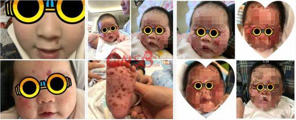 可怕!两个月大的宝宝被哥哥亲了一口,结果差点就没命了