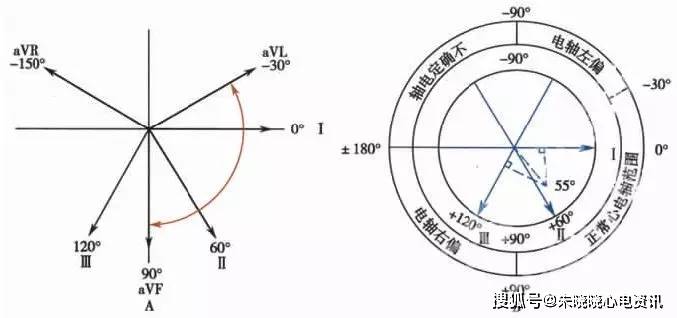 心电轴的测量方法,你掌握了几种?