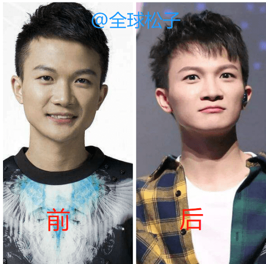 与出道前相比,周深的颜值"蜕变",从路人变成了小帅哥