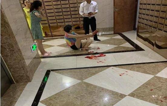 老人被狗绳绊倒重摔身亡飞来横祸责任究竟在谁