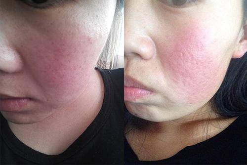 原创孕妈太馋水蜜桃妈妈见状只好劝阻怀孕后不能吃太多桃子