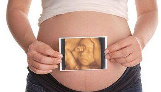 怀孕24周,目前有两个很重要的检查,一个是大排畸检查,三维彩超四维