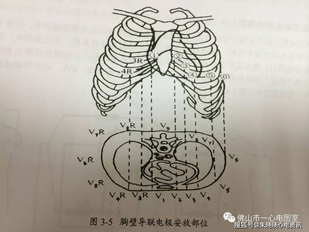 心电图导联向量图片图片