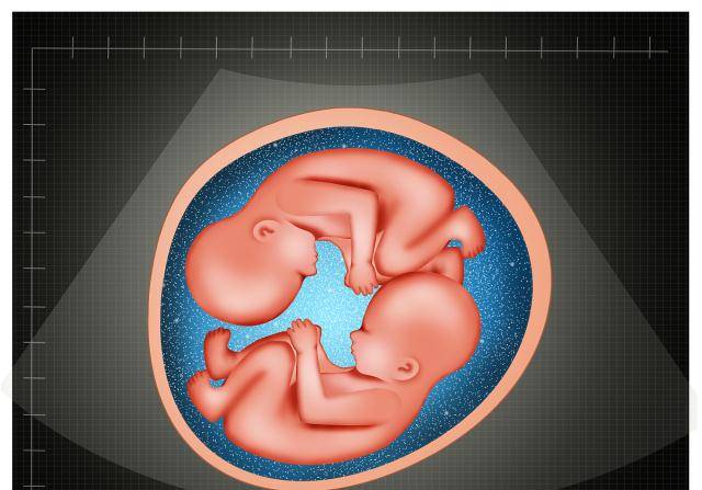 怀双胞胎有什么感觉?跟单胎有什么不同?这些信息孕妇要搞清楚