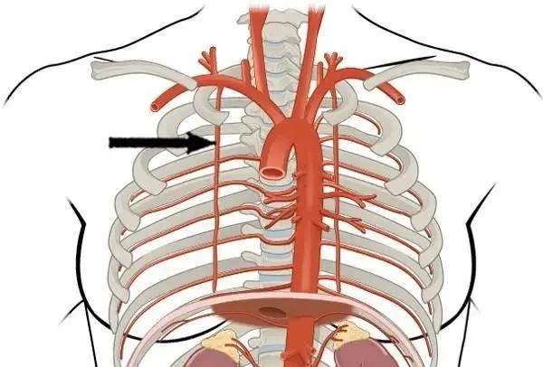 胸廓内动脉 乳内动脉图片