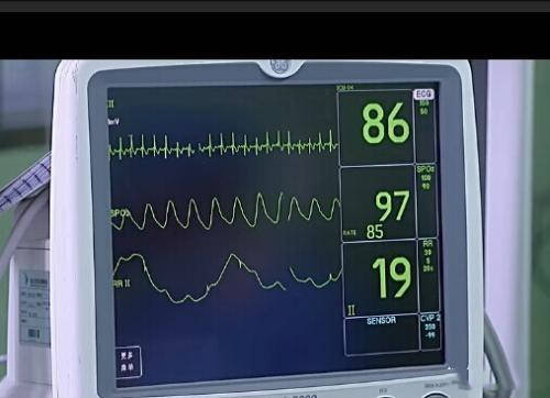 二,健康人的心率多少算正常心脏跳动的节律,也就是心脏跳动是否规律或