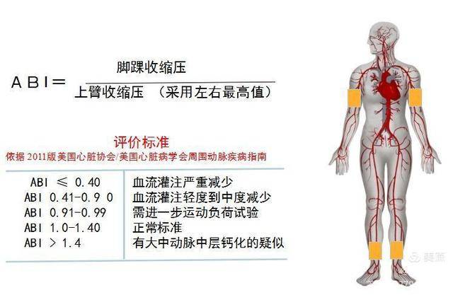 外周血管检测神器