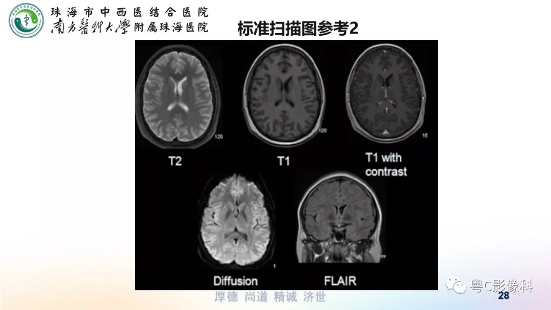 影像解剖,影像技術 :顱腦mri平掃掃描方案