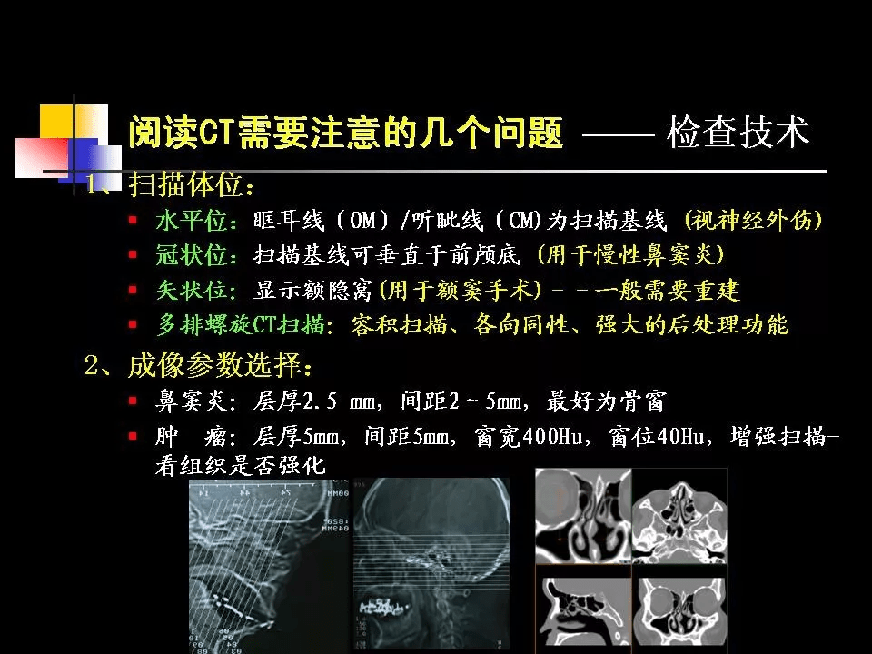 鼻腔鼻竇的ct解剖及該區域常見疾病的影像學診斷