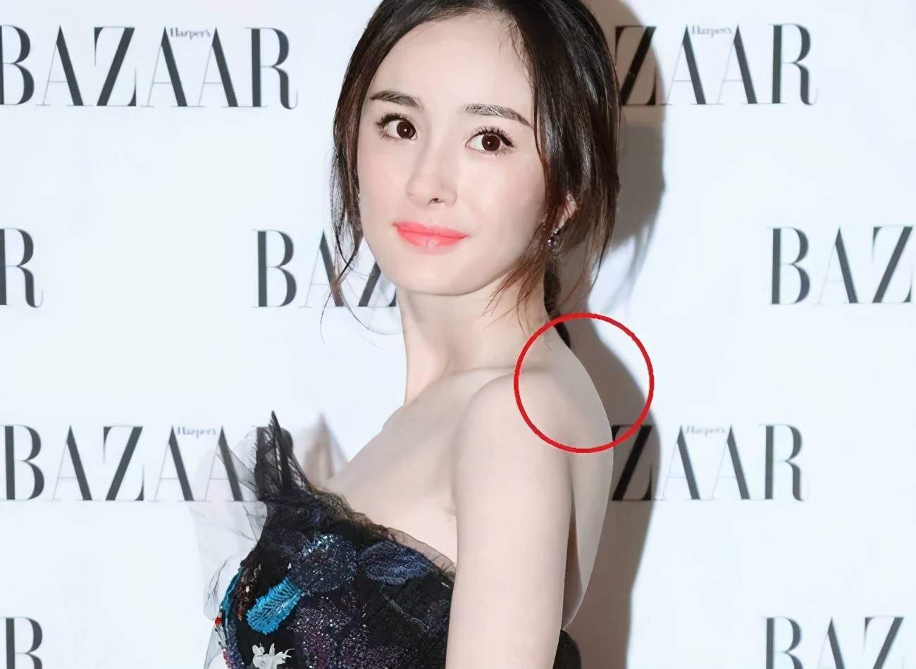 困扰女明星的富贵包竟是夺命包?