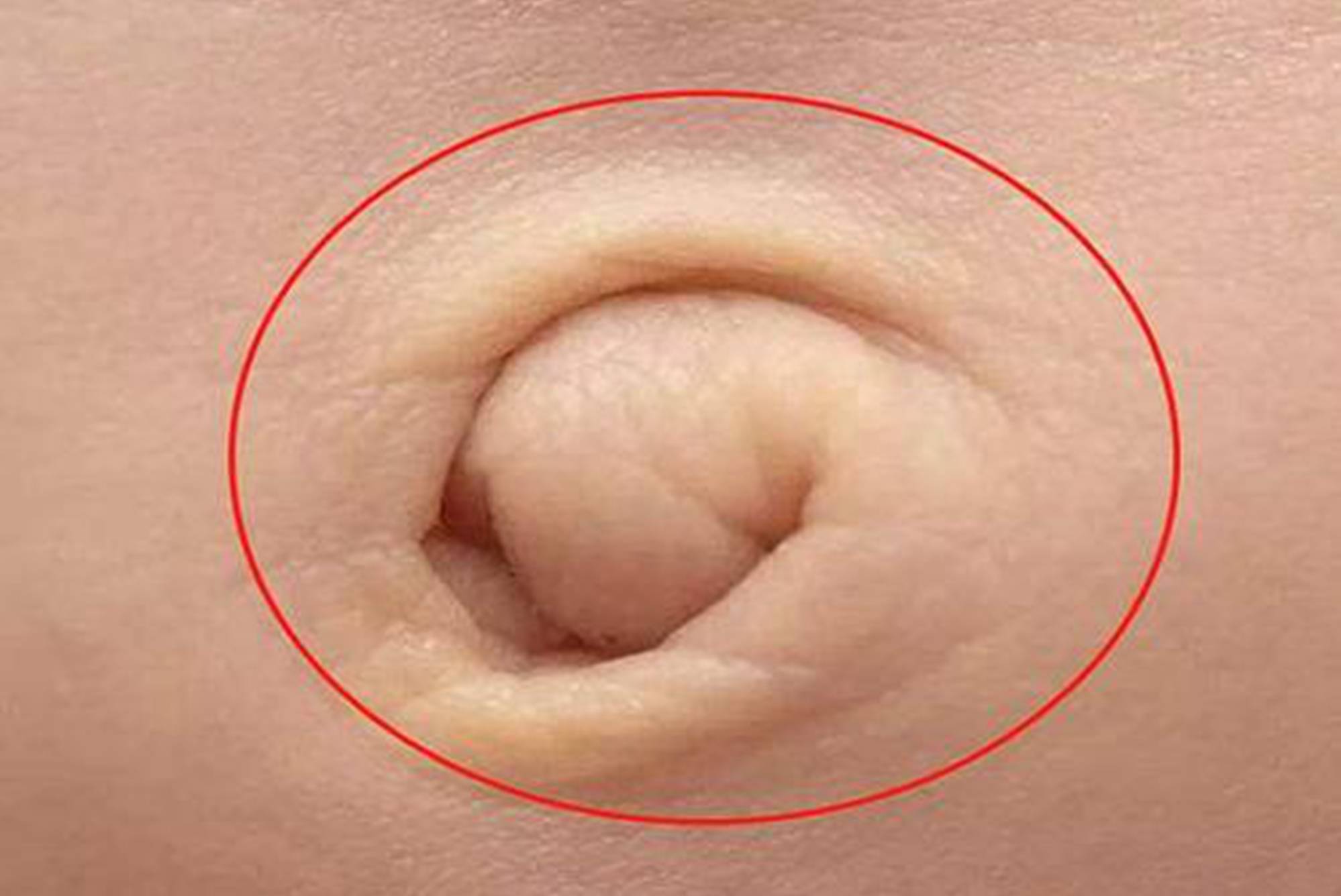 怀孕后的肚脐眼图片图片