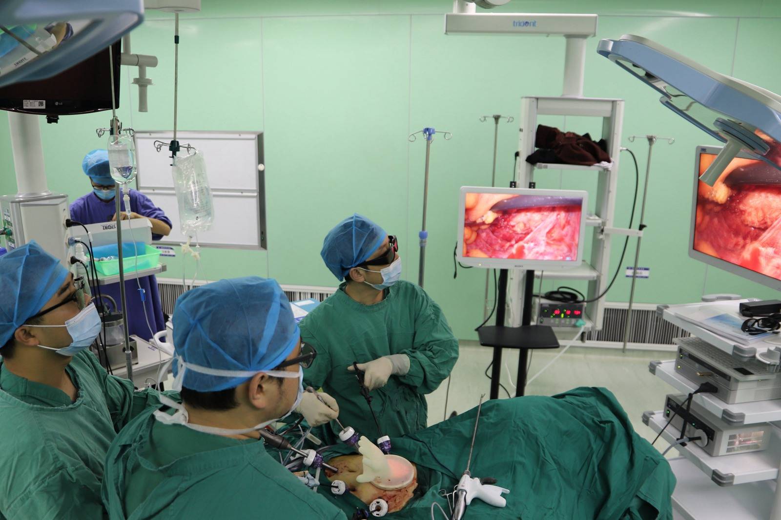 湘潭市第一人民医院引进新一代3d高清腹腔镜成功实施肠癌根治术