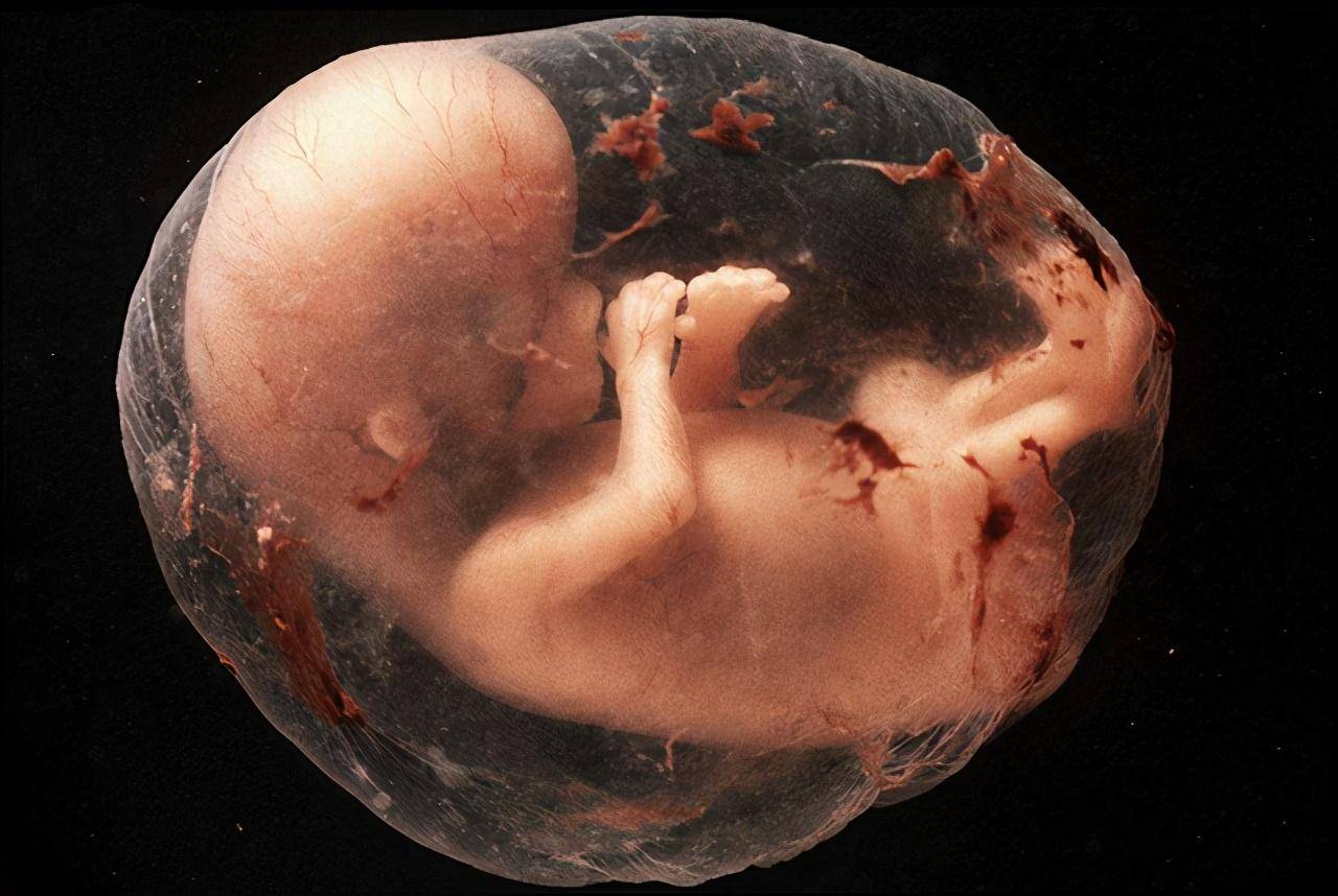 胎儿28周图片