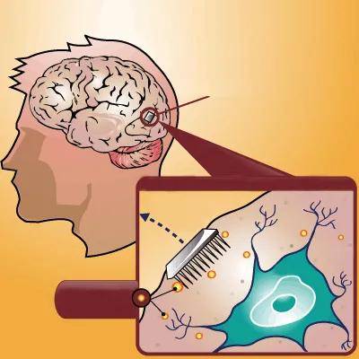 发展大势脑机互联让脑控不再遥远