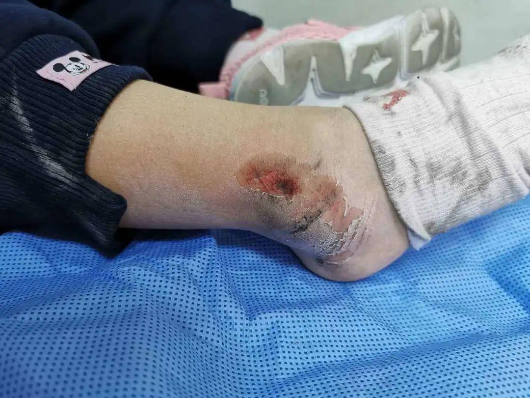 防孩子的小脚被卡 自行车上的"救生圈"你有吗