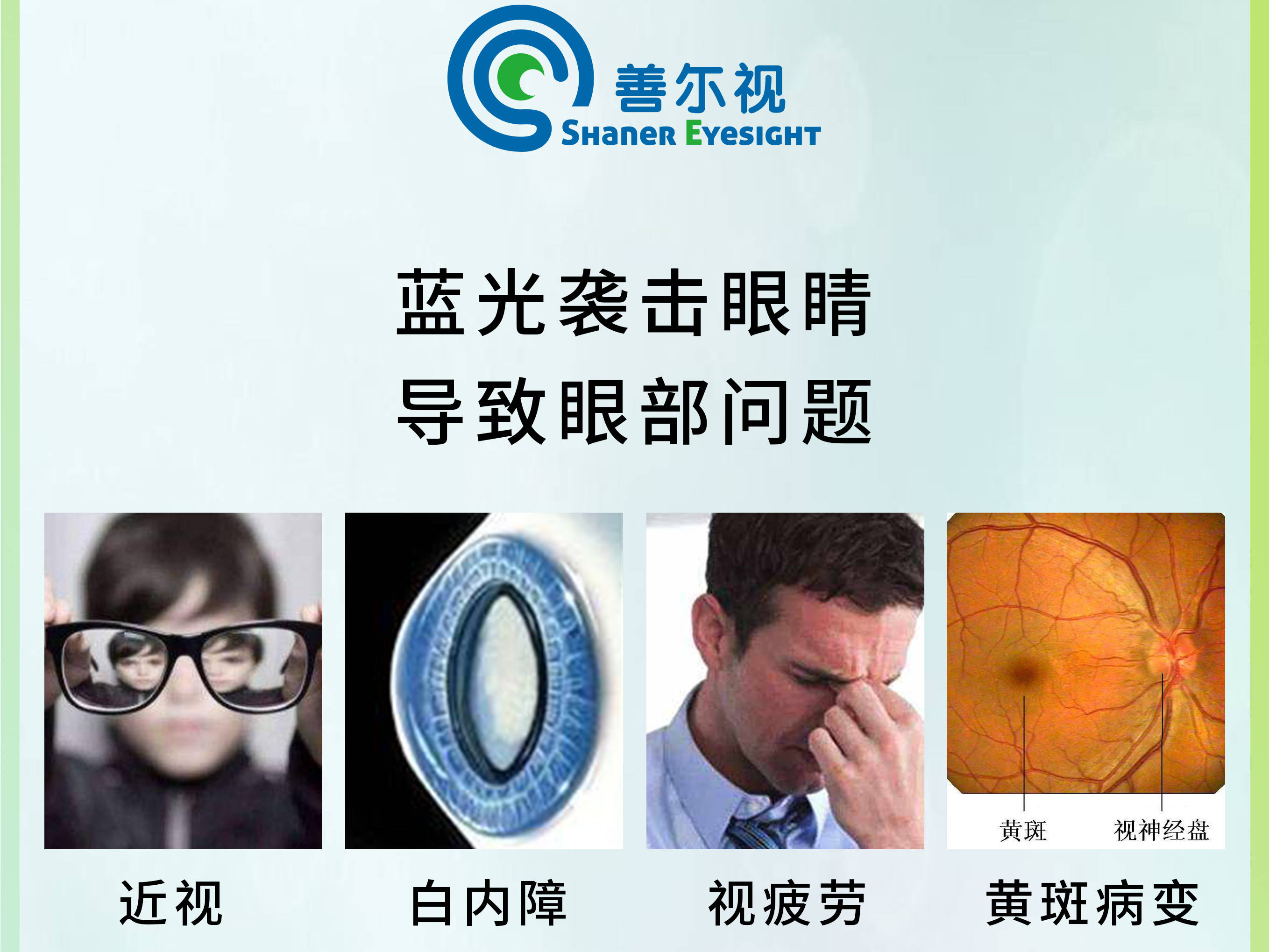 手机蓝光伤害眼睛 引起眼部视疲劳 导致黄斑病变,导致白内障