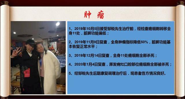 肿瘤克星悬壶济世患者福音邹锐