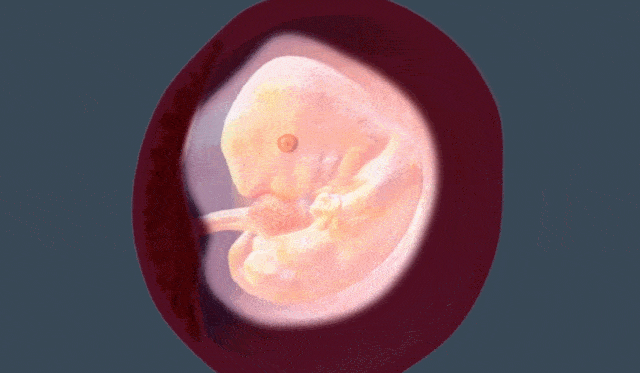 孕期12周的胎儿的图片图片