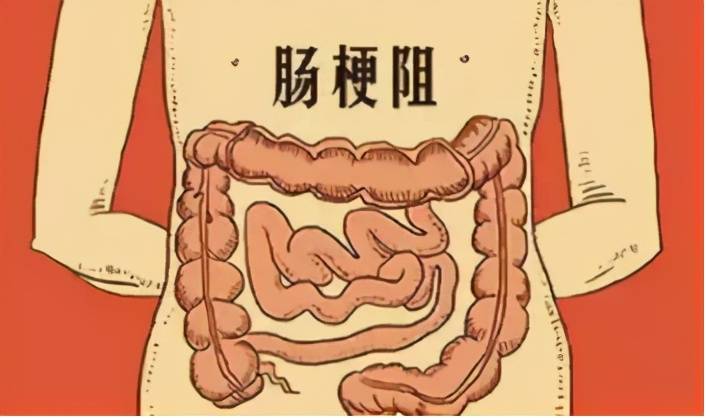 肠鸣频繁惹尴尬为啥肚子总是咕咕叫