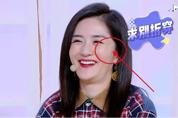 谢娜的脸怎么了?笑起来眼角出现奇怪大坑,引人质疑是整容后遗症
