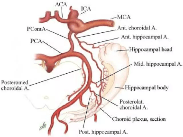 脉络膜动脉图片